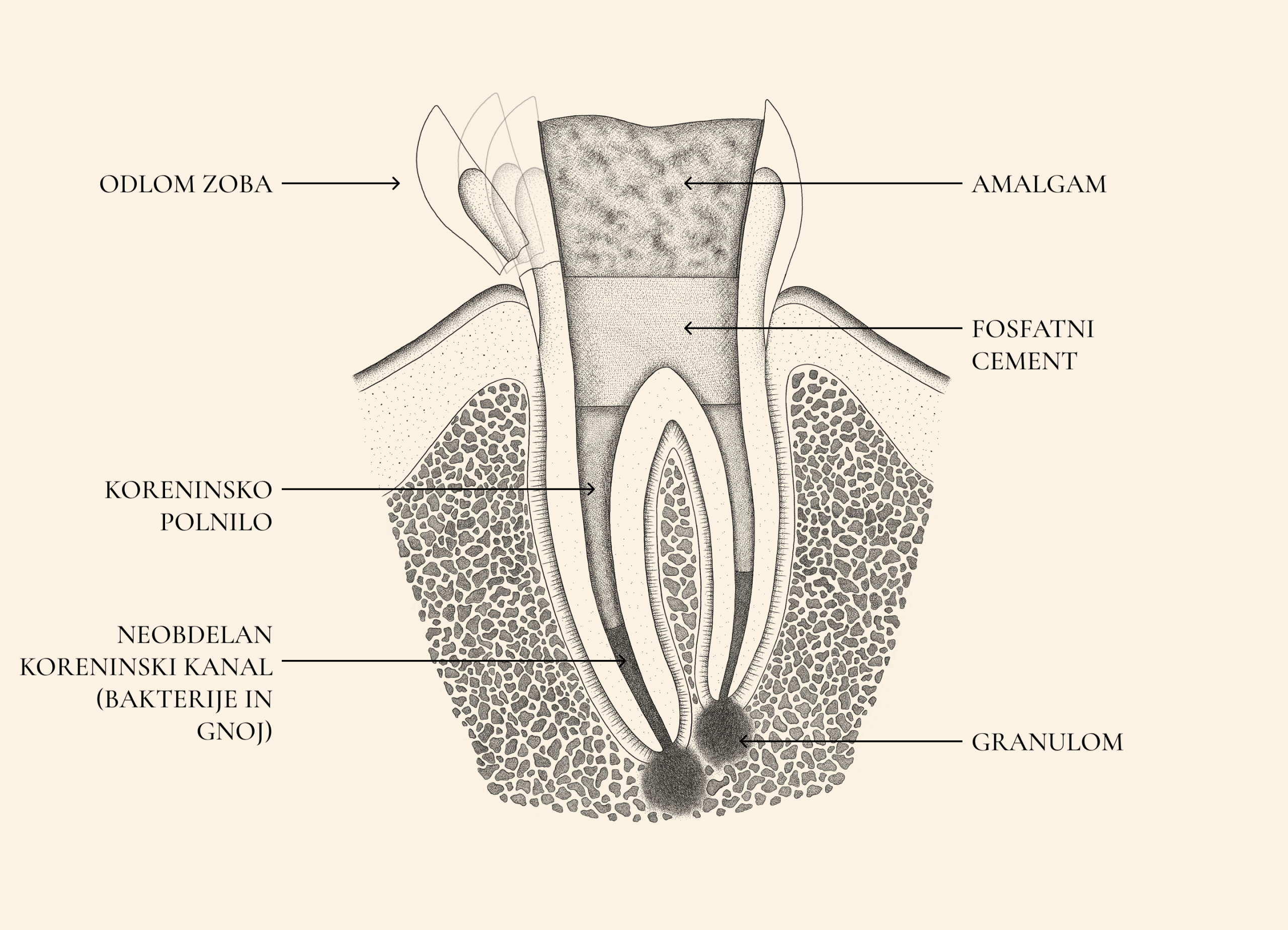 ustna_medicna_illustration